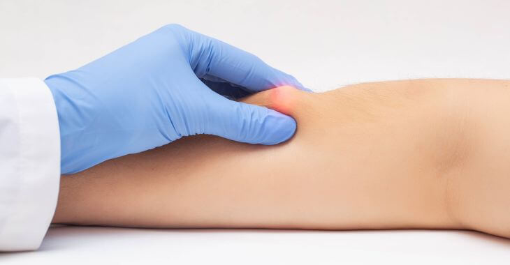 A doctor examining a lump on patient's hand.